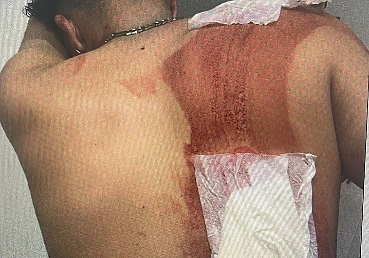 Herido de gravedad un joven de 19 años tras recibir varias puñaladas en Mejorada del Campo