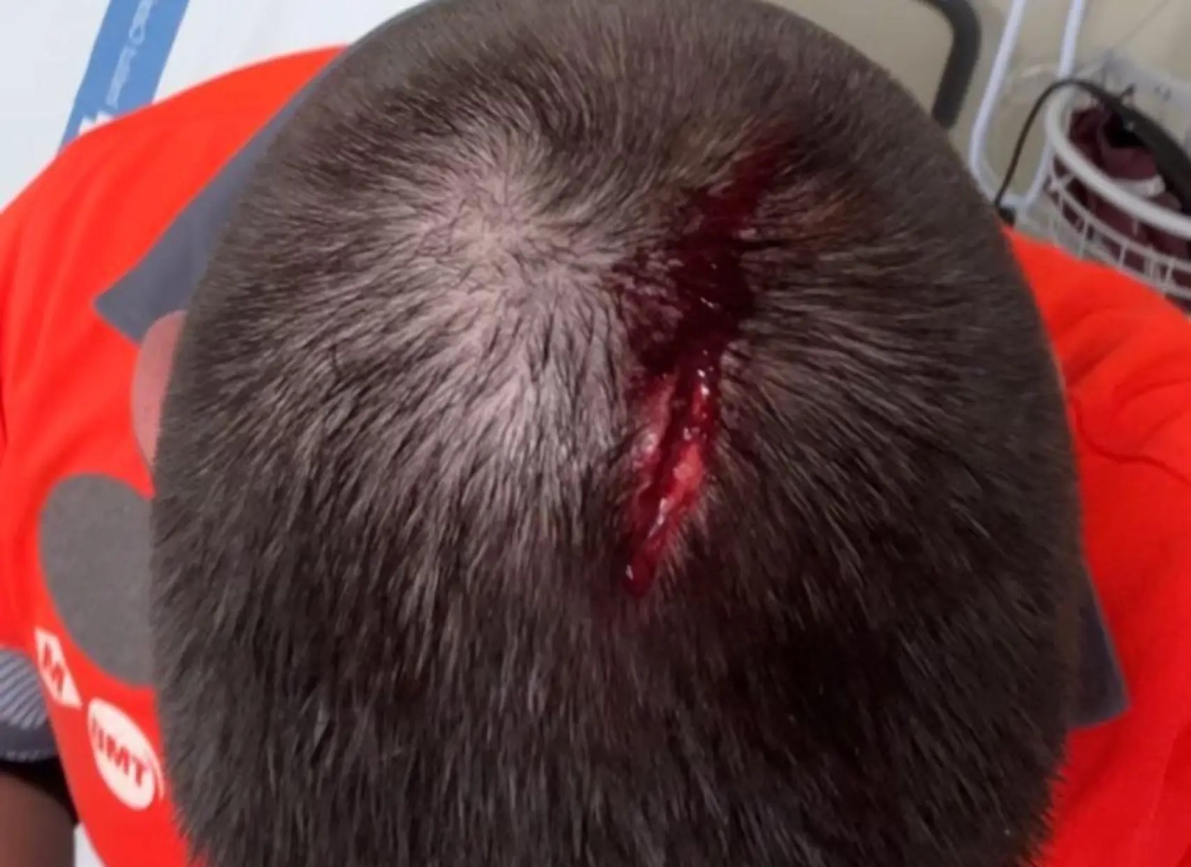 Agresión a tres vigilantes en el metro de Barcelona con gas pimienta y objetos contundentes