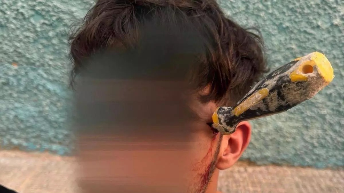 Dos detenidos tras una grave reyerta en Alicante en la que un joven acabó con un destornillador en la cabeza