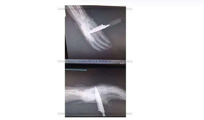 Un policía nacional sobrevive al ataque de un hombre que le apuñaló durante una disputa familiar en Baza