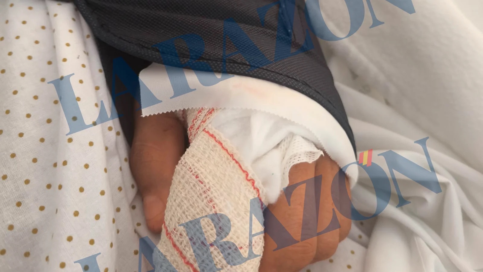 Detenido en Garrucha un hostelero tras amputar de un mordisco un dedo a un guardia civil en un brote psicótico