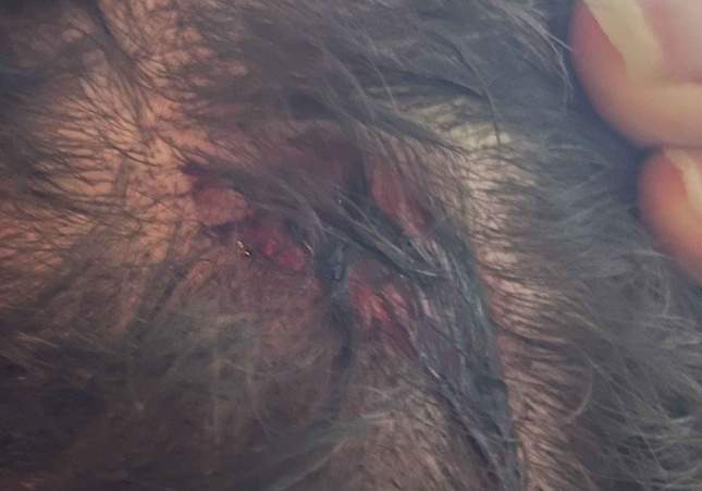 Denuncian una agresión homófoba en un bar de Mollet del Vallès: golpes y amenazas de muerte con una navaja