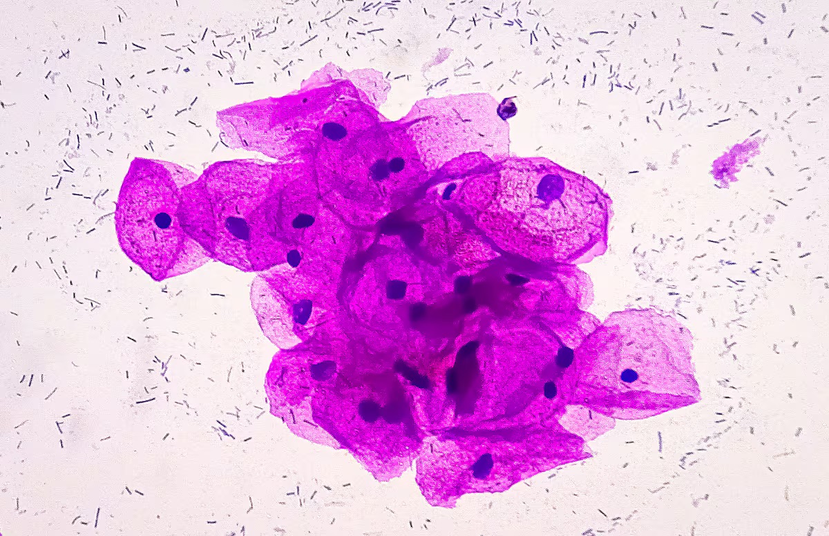 Galicia, primera sanidad pública del mundo en ofrecer la vacuna Bexsero para prevenir la gonorrea en grupos de riesgo