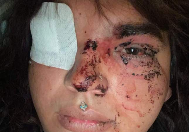 Una mujer trans denuncia una agresión en grupo motivada por transfobia a la salida de un local en León