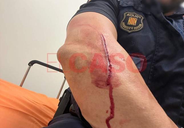 Cinco mossos heridos en Vic al detener a dos hermanos con antecedentes: uno tenía una orden de arresto pendiente