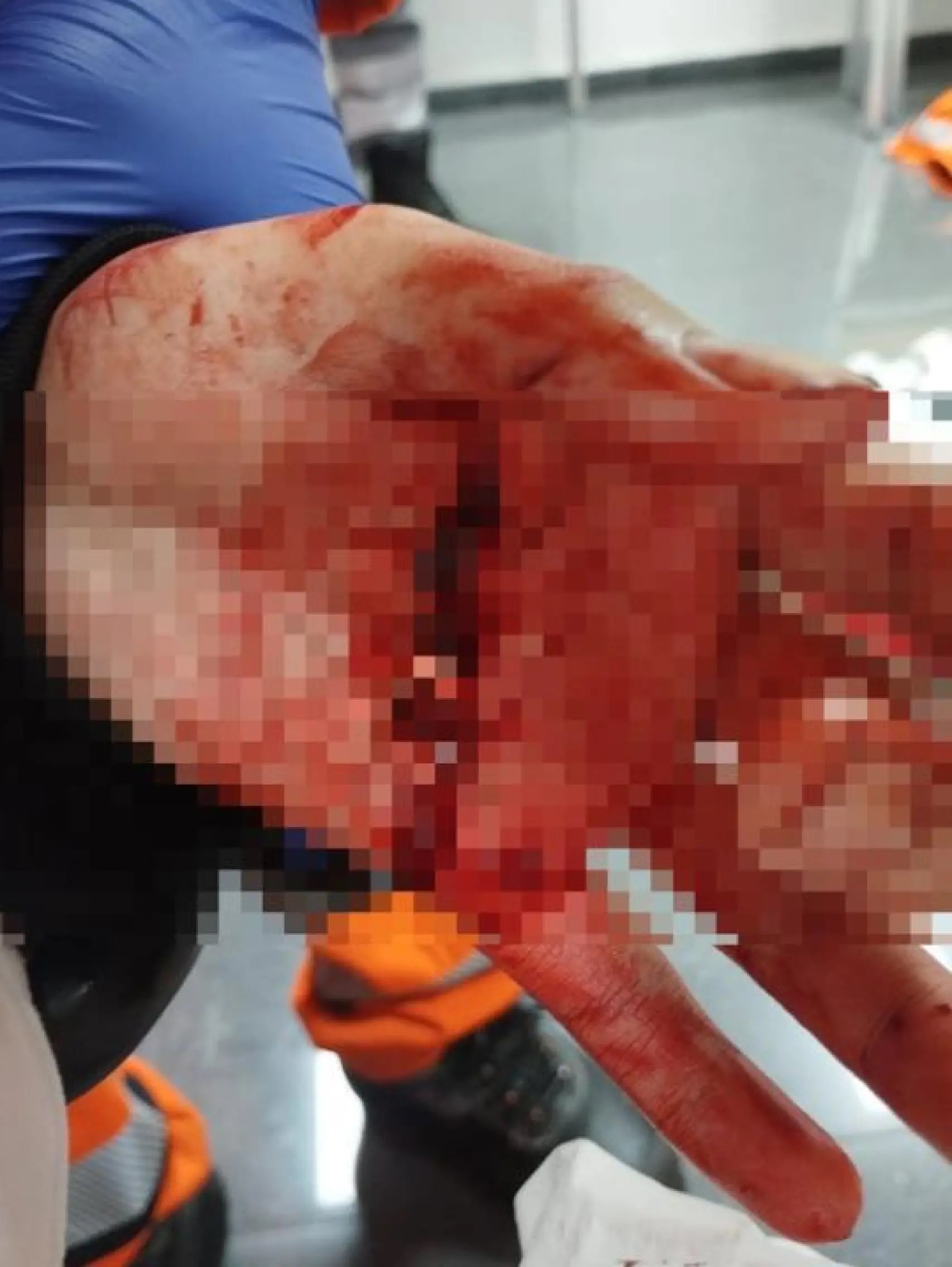 Un herido con graves cortes tras sufrir un ataque con machetes en la estación de metro de Vall d'Hebron