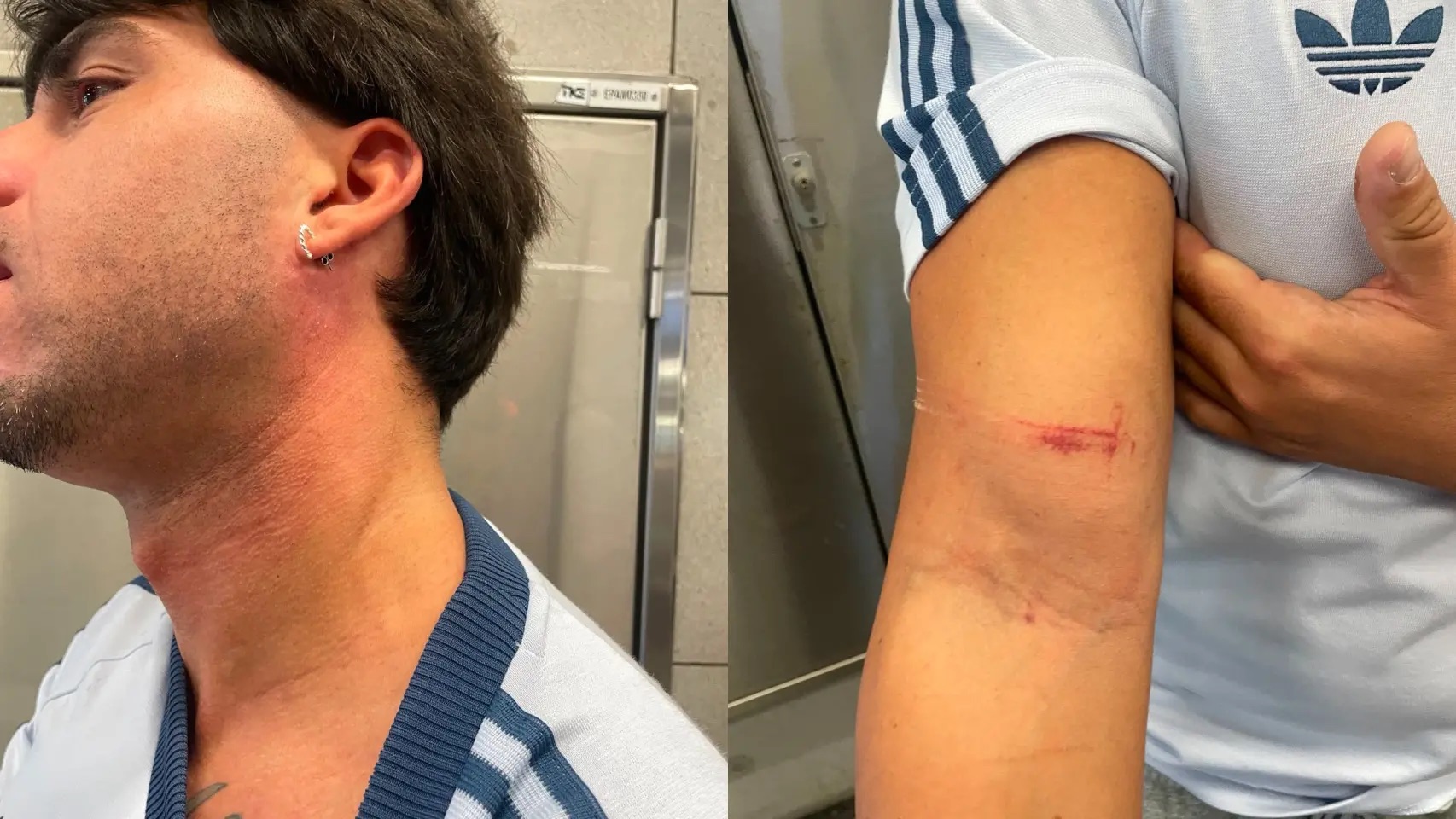 Dos ladrones agreden a un joven y le roban la cadena de su abuelo en la L2 del metro de Barcelona